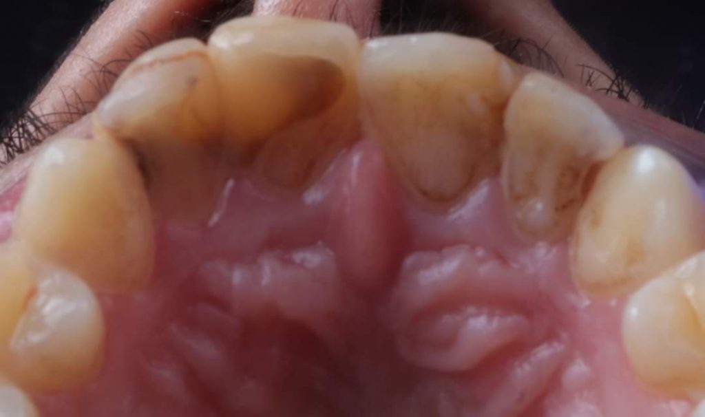 FB_IMG_1657135149440