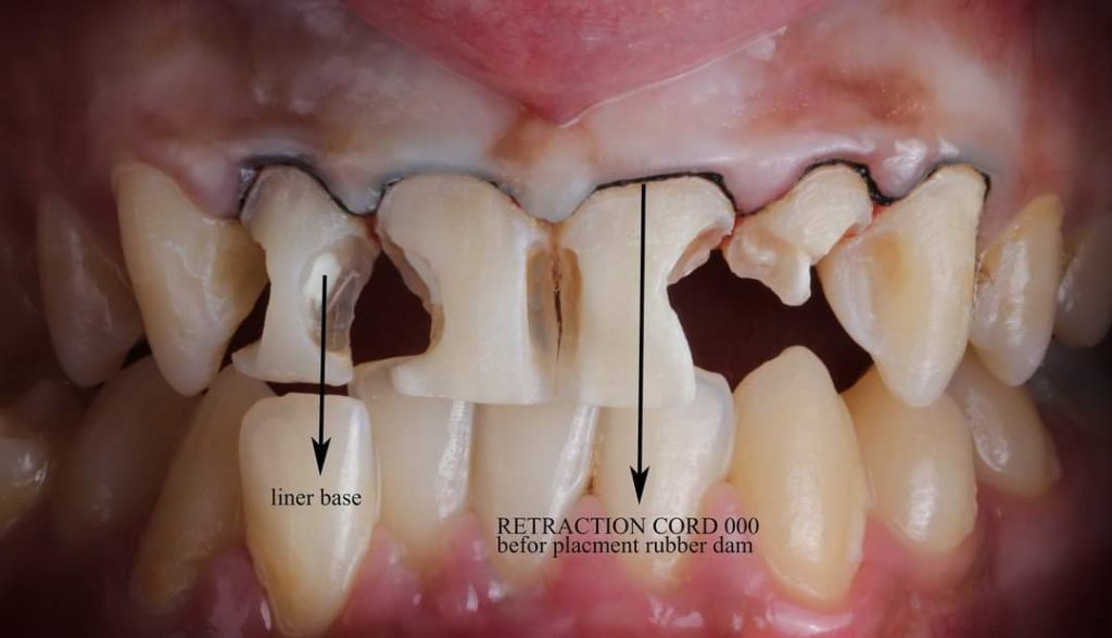 FB_IMG_1657135158839