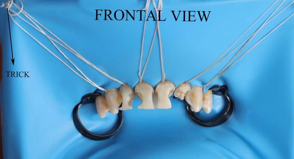 FB_IMG_1657135165329