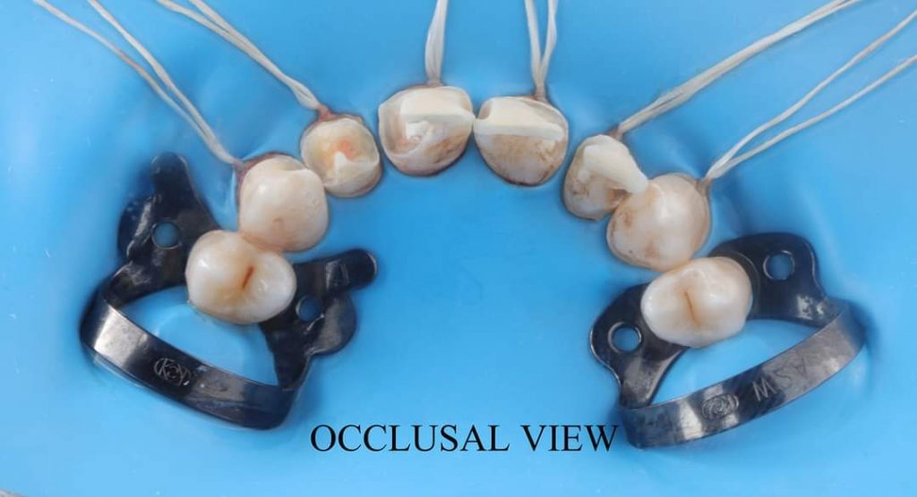 FB_IMG_1657135167621