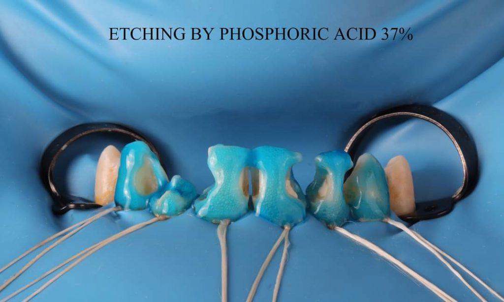 FB_IMG_1657135176381