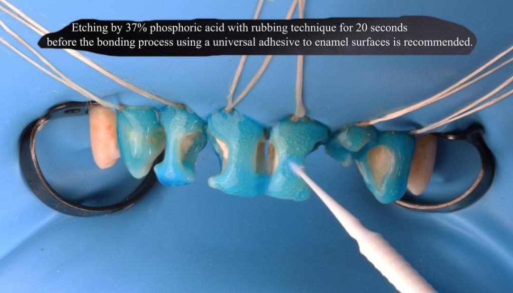 FB_IMG_1657135179018