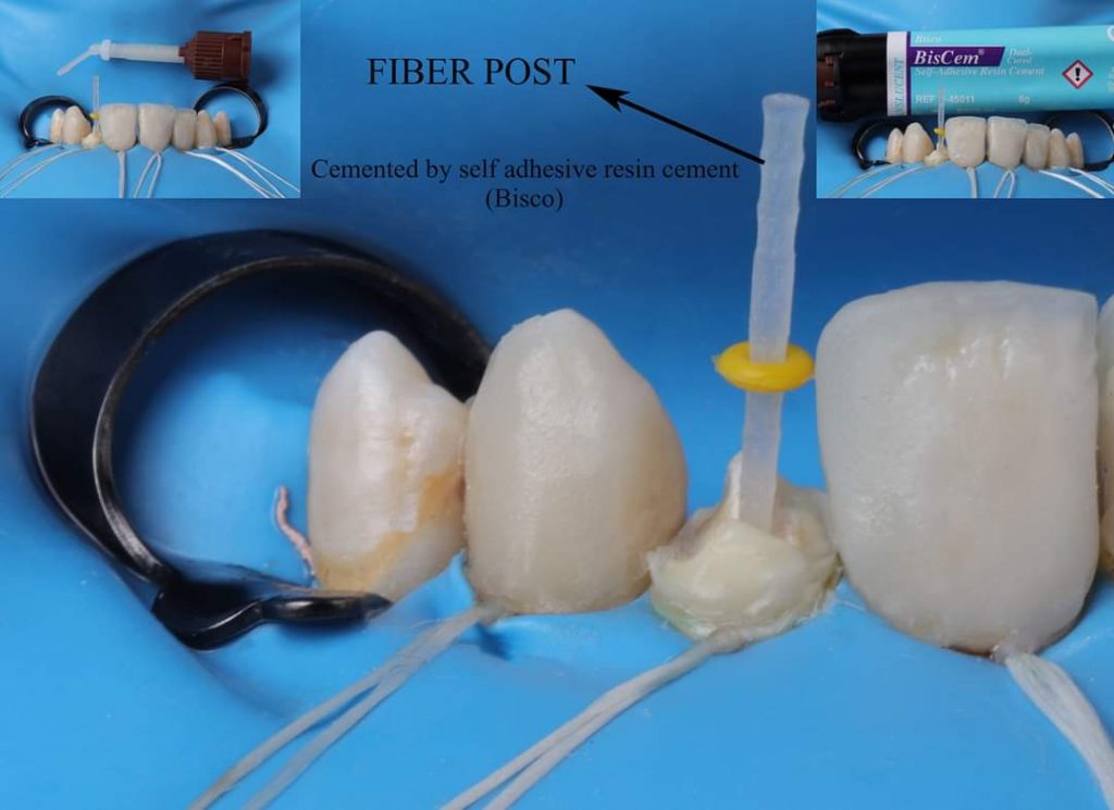 FB_IMG_1657135197847