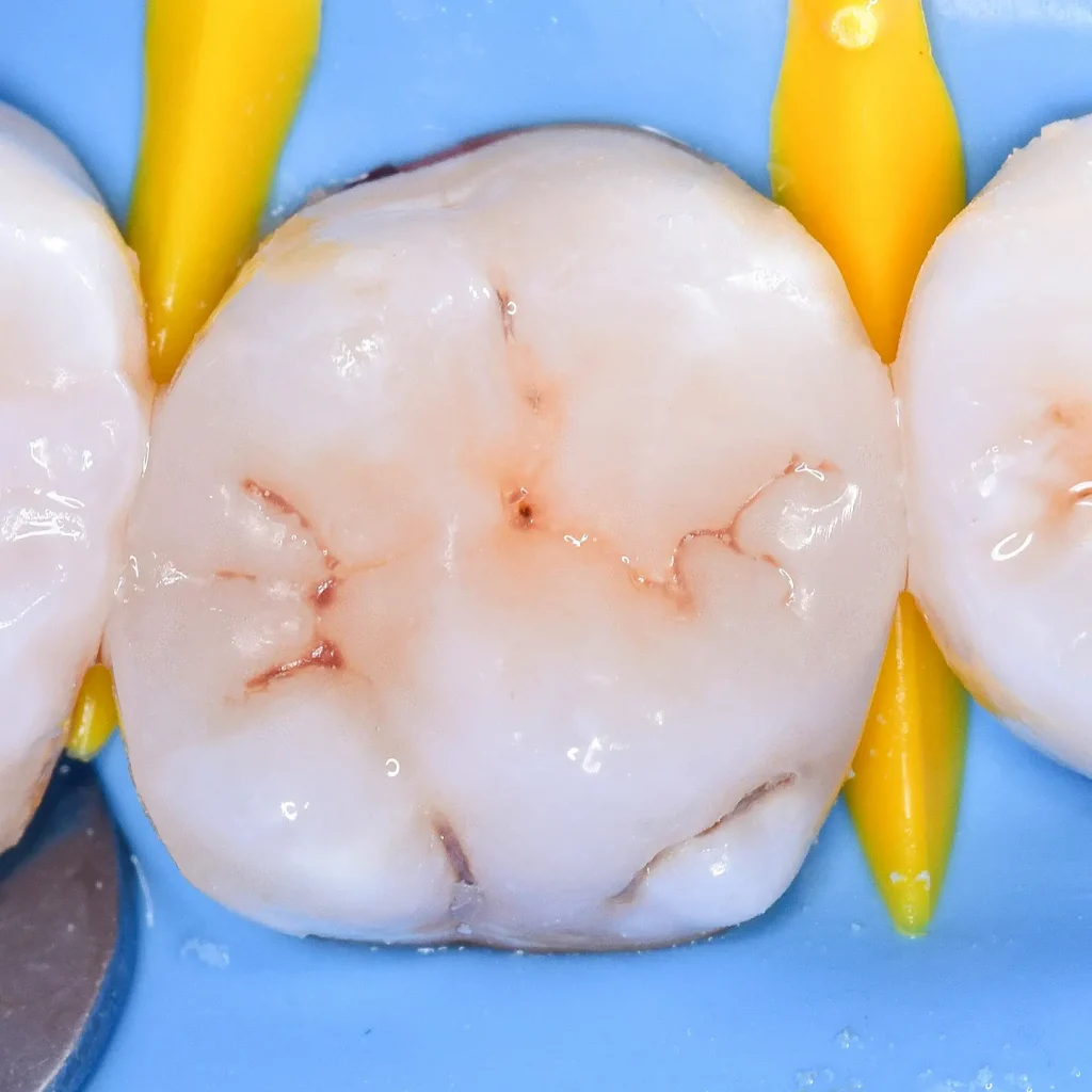 IMG_20220718_201012_859