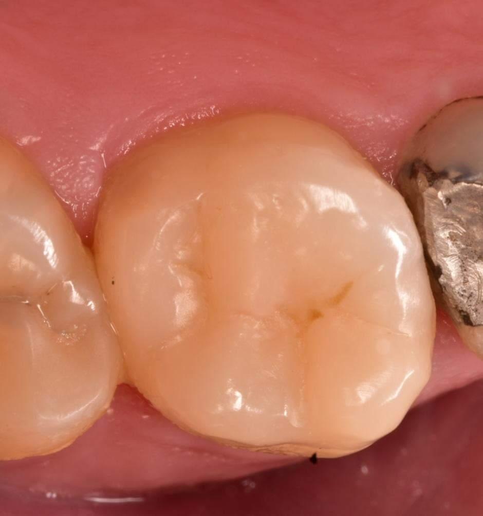 IMG_20220806_182750_145