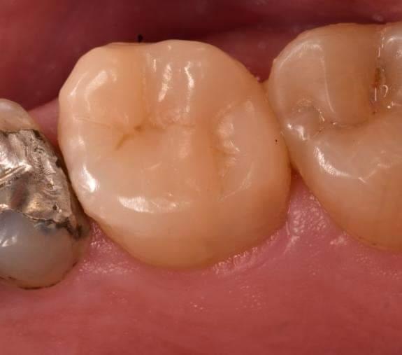 IMG_20220806_182752_098