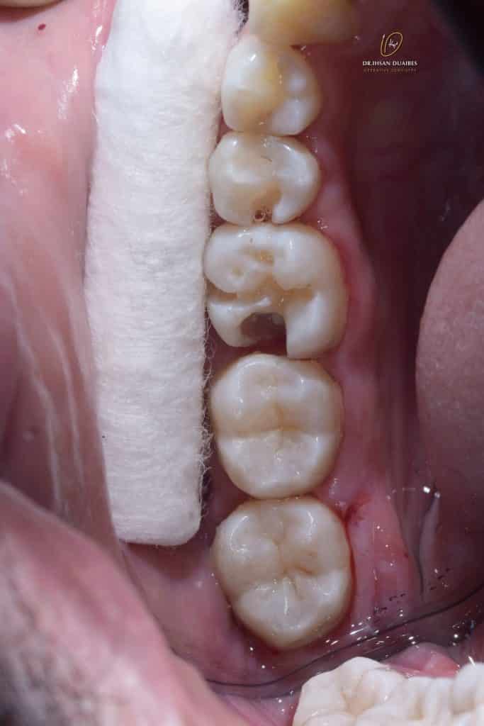 Picsart_22-07-16_17-14-20-449