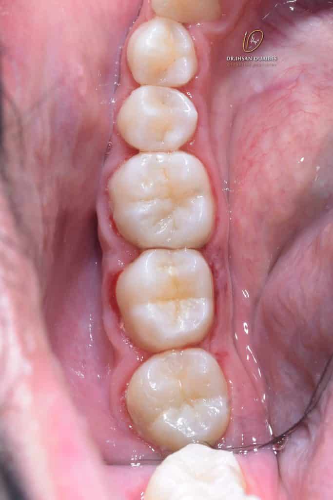 Picsart_22-07-17_22-11-35-225