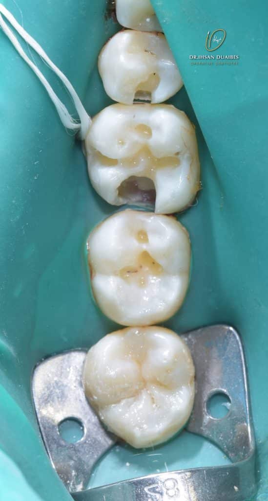 Picsart_22-07-17_22-17-27-194