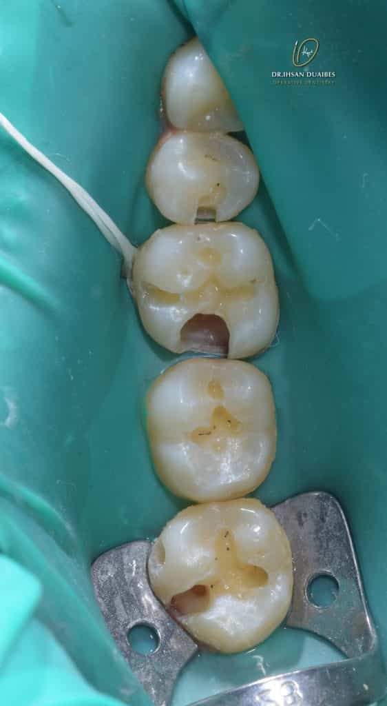 Picsart_22-07-17_22-19-54-439