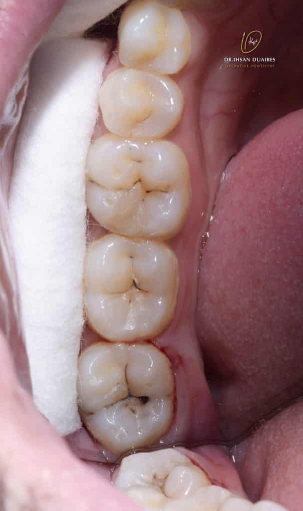 Picsart_22-07-17_22-21-39-776