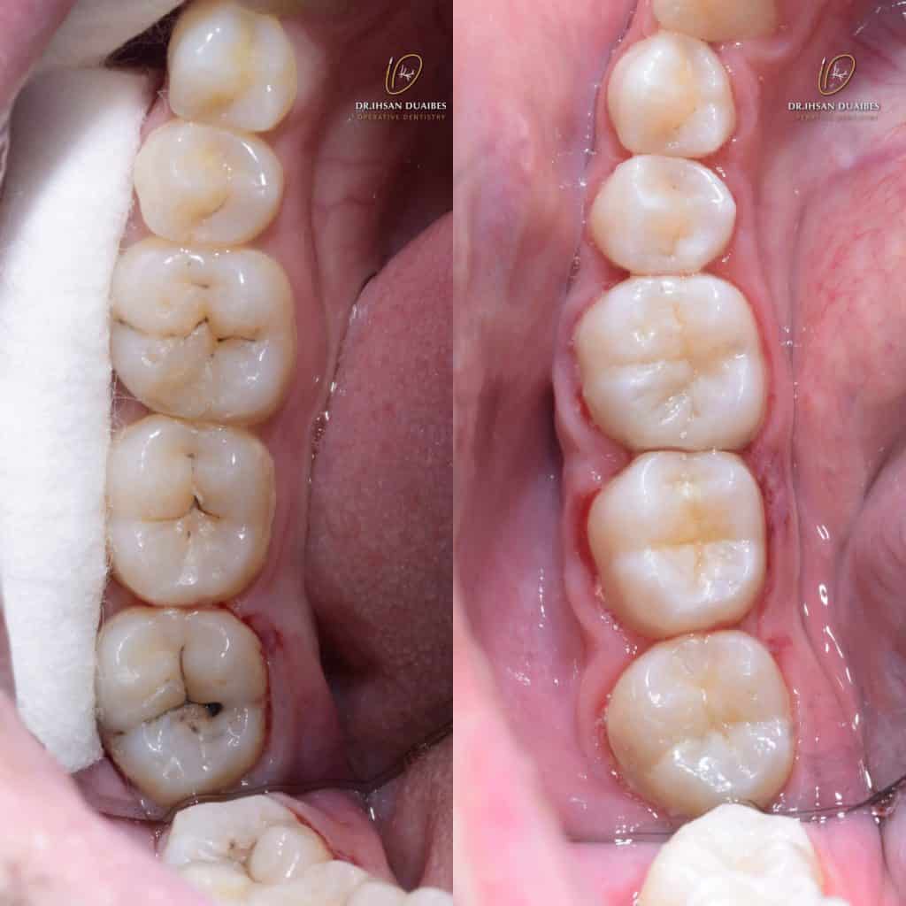 Picsart_22-07-17_22-48-33-253