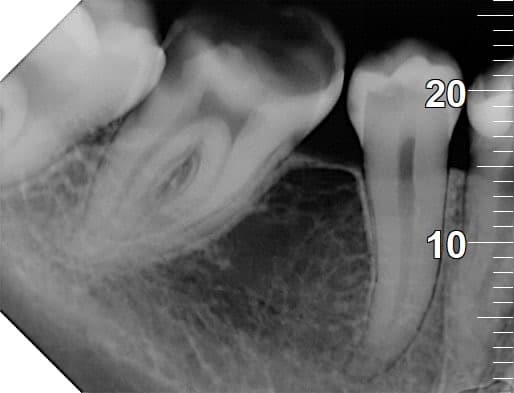 1955FE24-68D1-447F-A5D7-5EB60EB14053