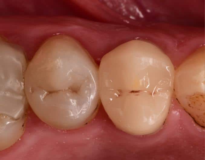 331889605_870039850744332_1845549974979991927_n