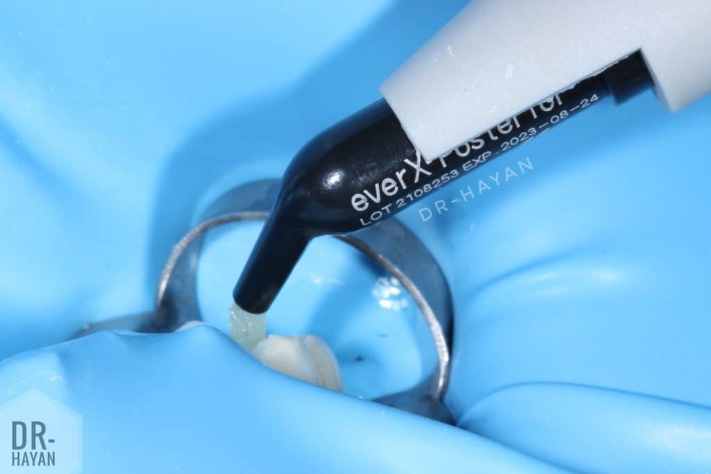 8EB7DF6B-99DB-4E26-917B-22B60A66E25A