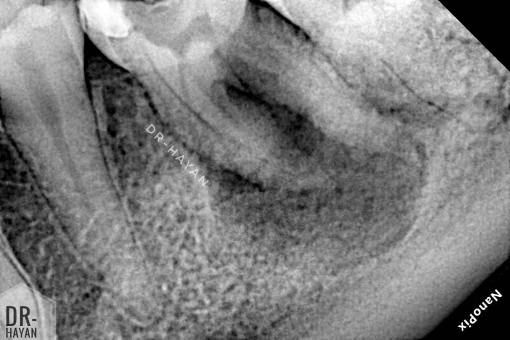 99F5F4F3-A774-4FEE-BD6B-27D553427A33