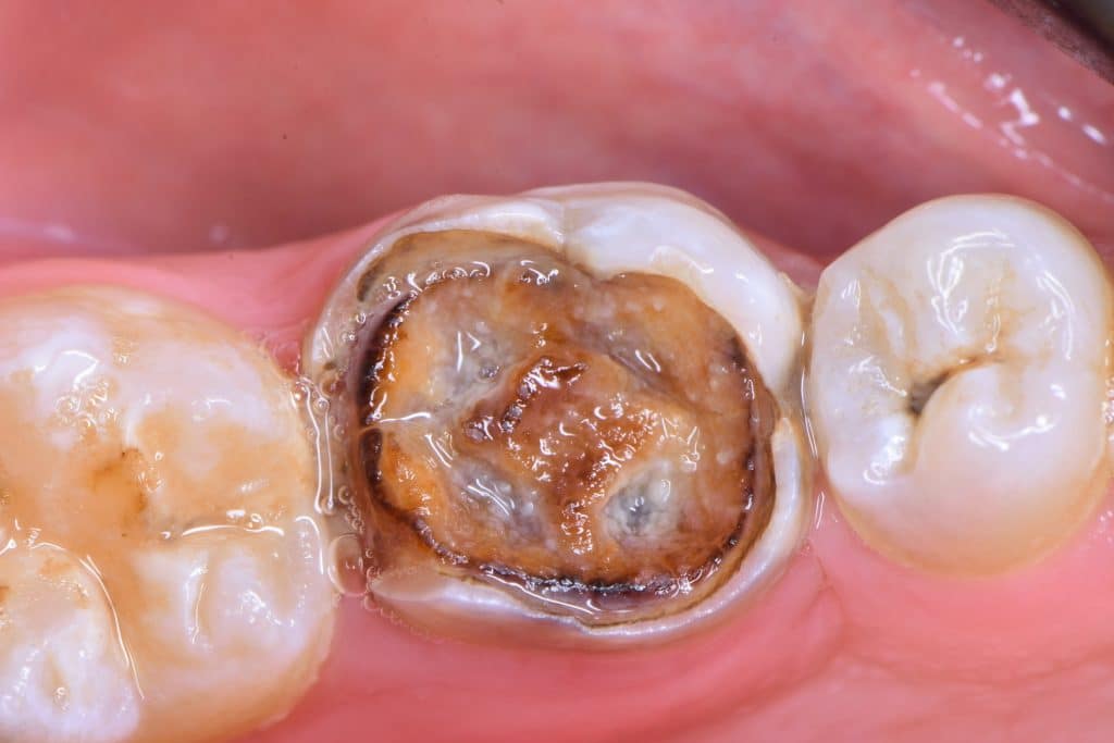 A2356485-B54E-4CA5-B7B6-4A899CEF1135