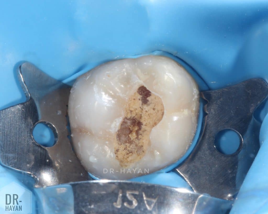 BDD0DB08-63B2-48EA-B4FB-B02F7C022FCA