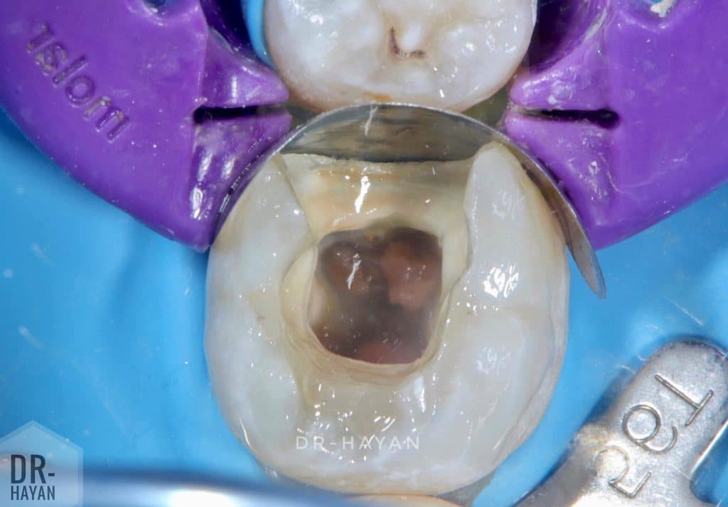 F0F0A1F3-6501-4648-B109-520ABF338955