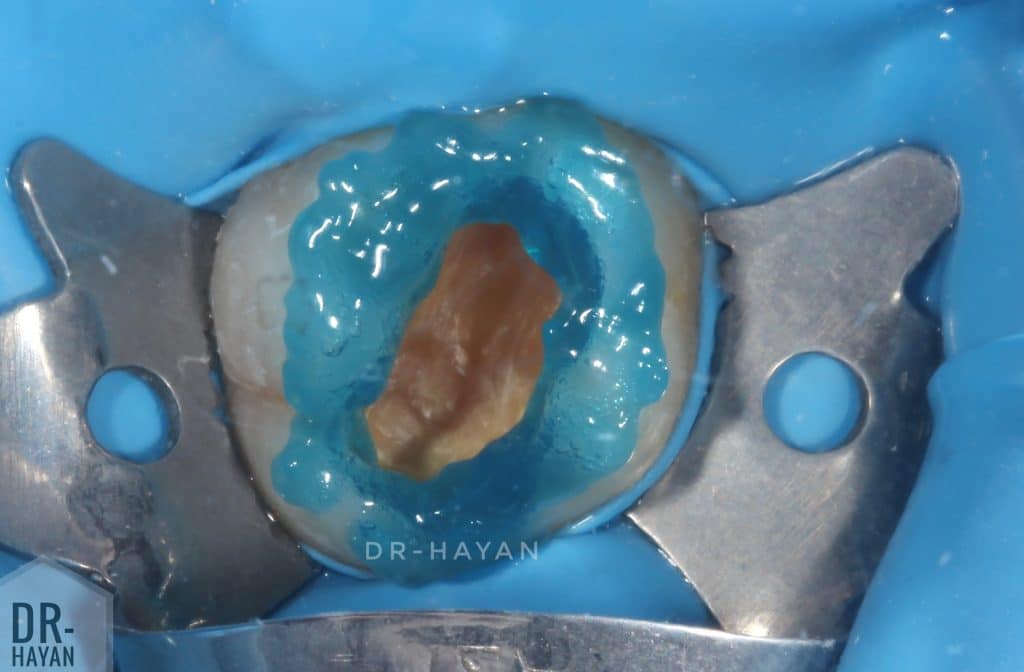 F17DEF63-F353-4D0F-B822-1C5B00BBD5B0