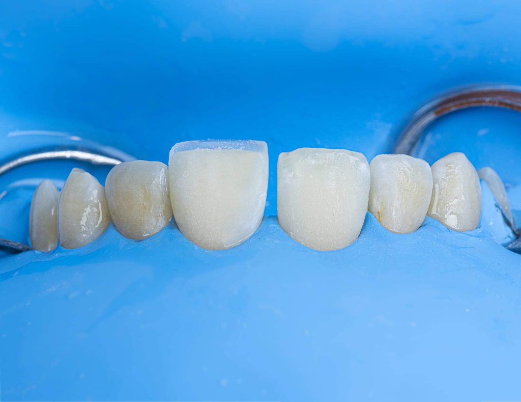 FB_IMG_1661635813962