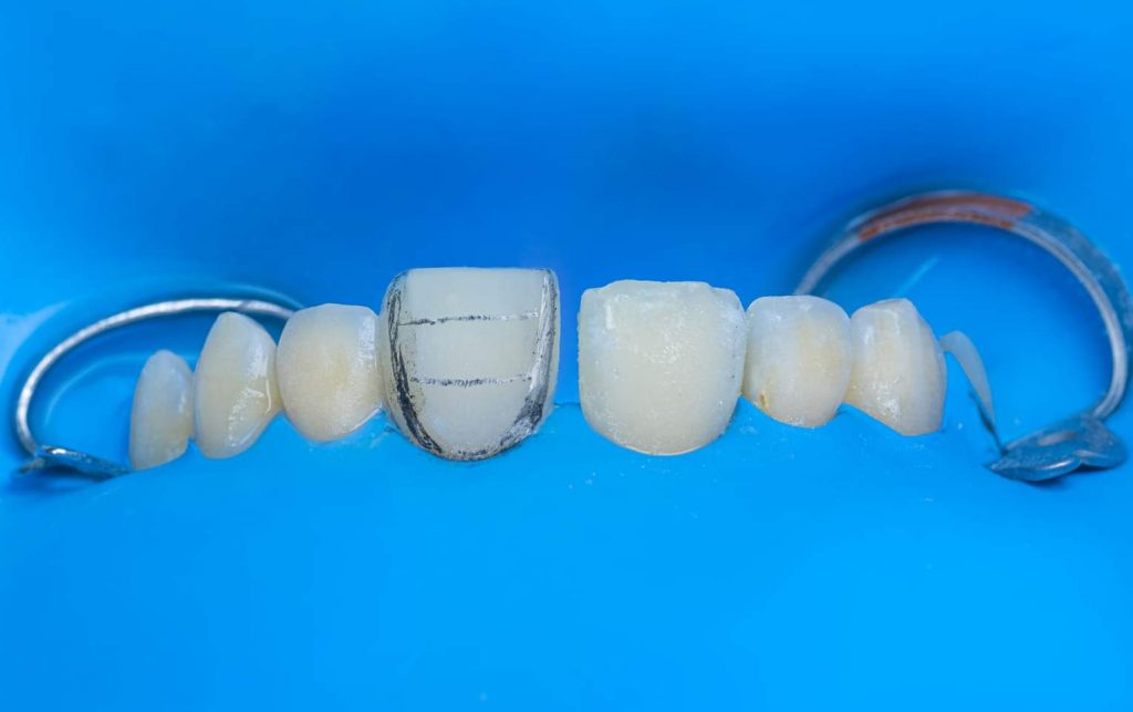 FB_IMG_1661635821256