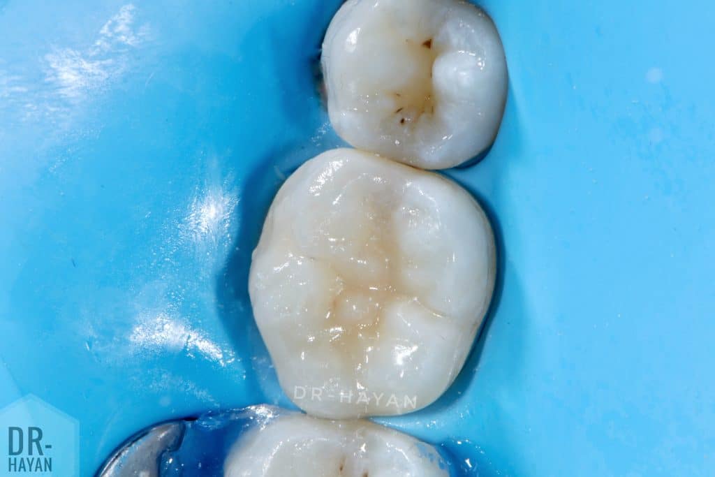 FDD5245D-FC2B-4B64-9D1A-91A82A55ED88