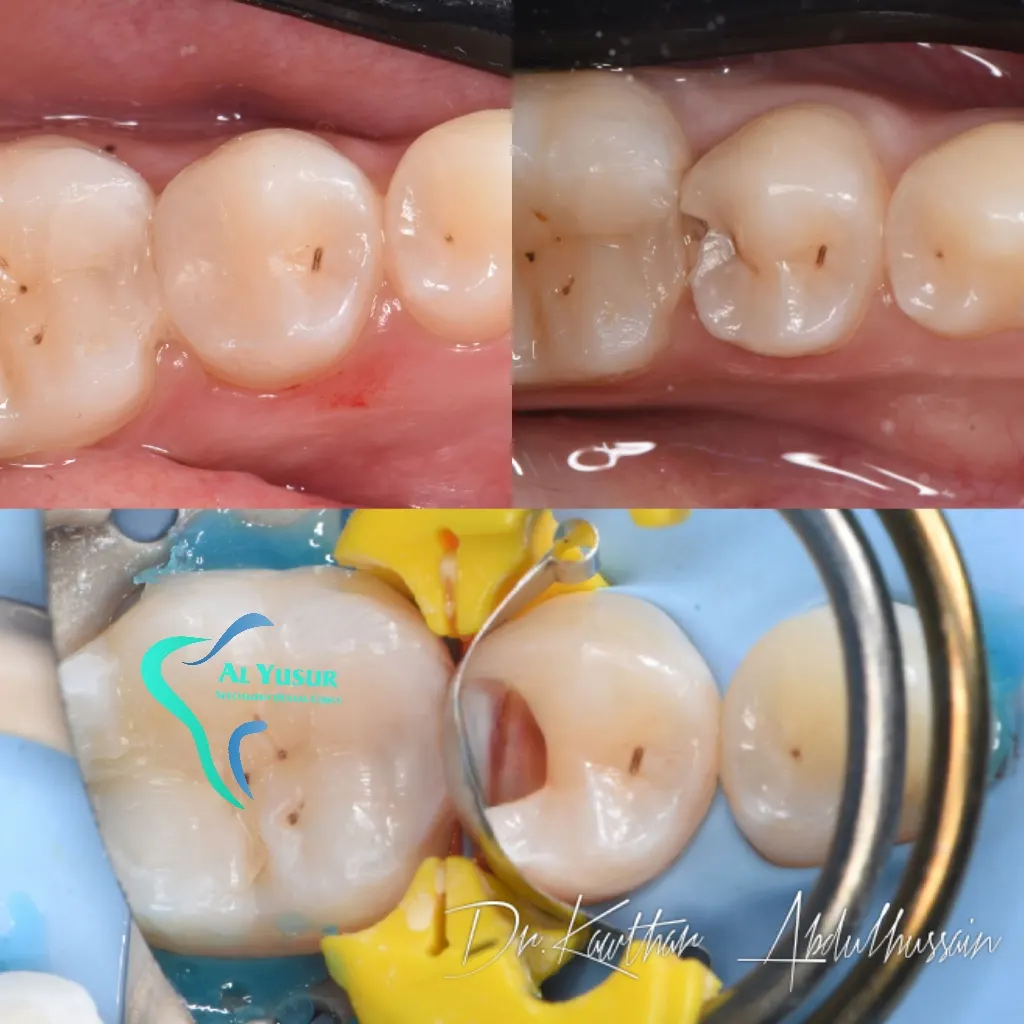 IMG_20220810_153727_677