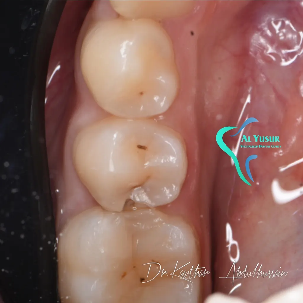 IMG_20220810_153727_740