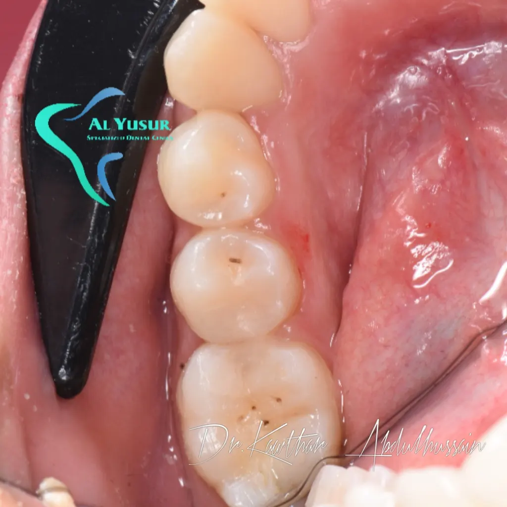 IMG_20220810_153727_848