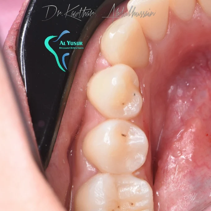 IMG_20220810_153727_955