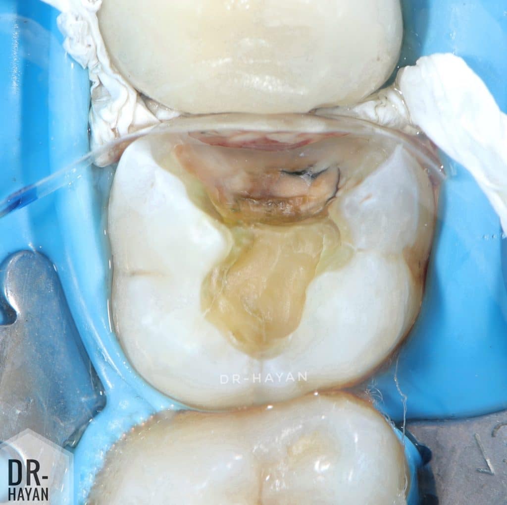 62A488D8-577B-4FF2-8983-CC765BFA510C