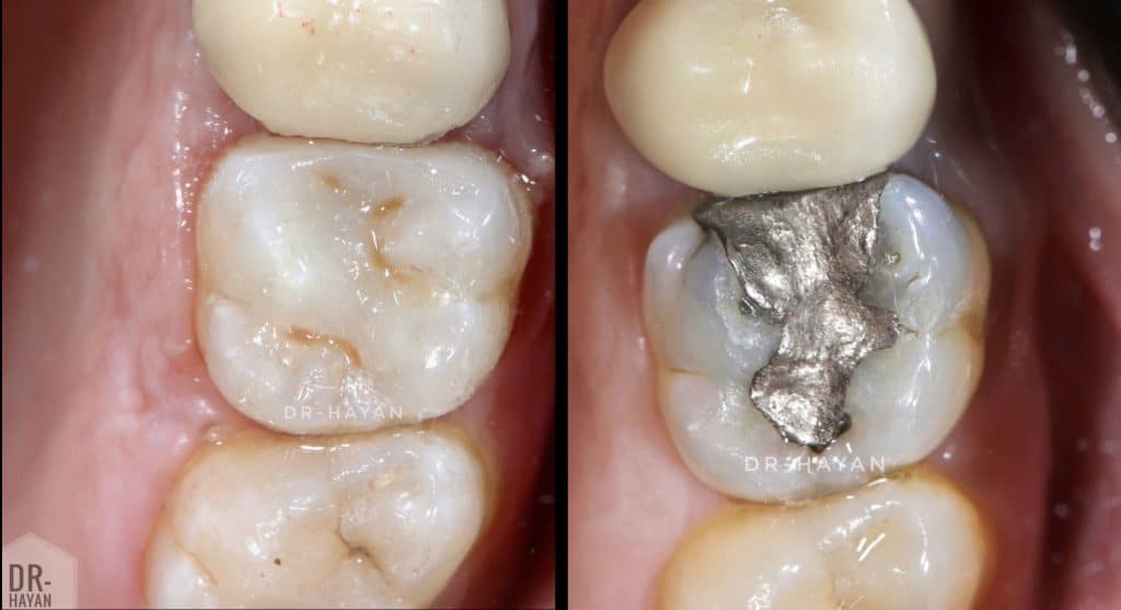 8AA9400D-81A4-4277-8F56-BC51B59CA50A