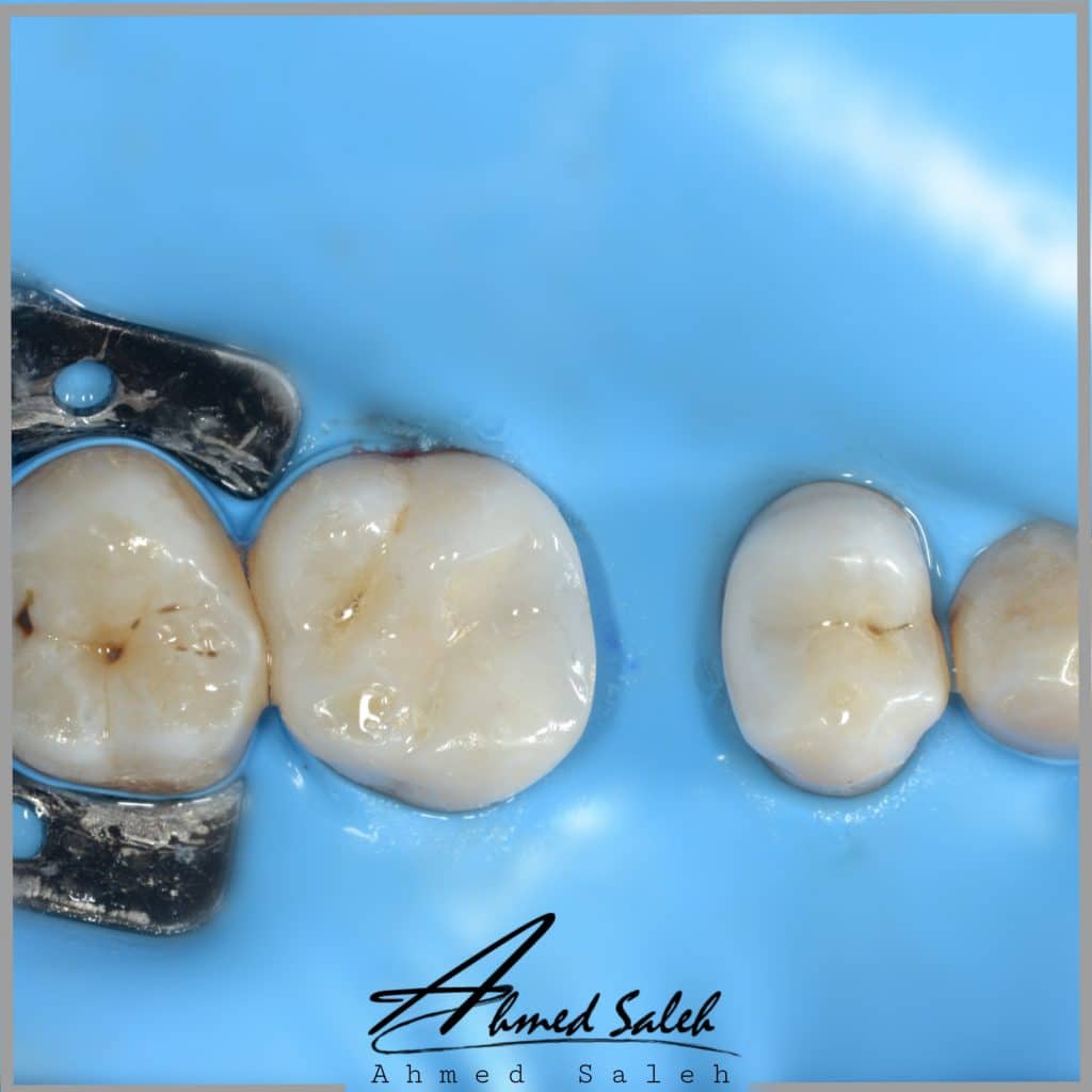 00FFBD80-25C6-47D5-9A7B-B11AB3D4F4A7