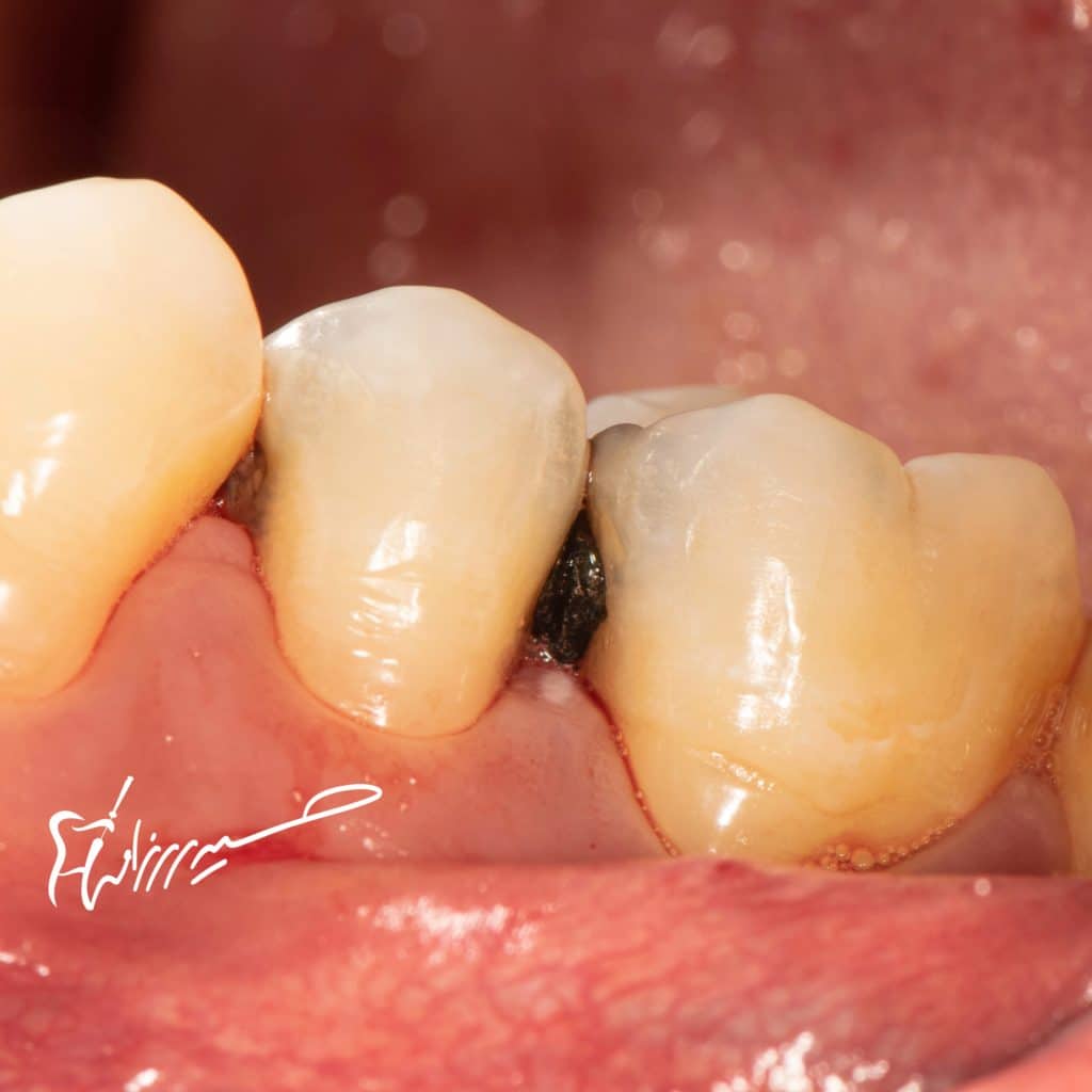 03DAE9CD-E1D9-44DA-A120-A33E6CE84B68