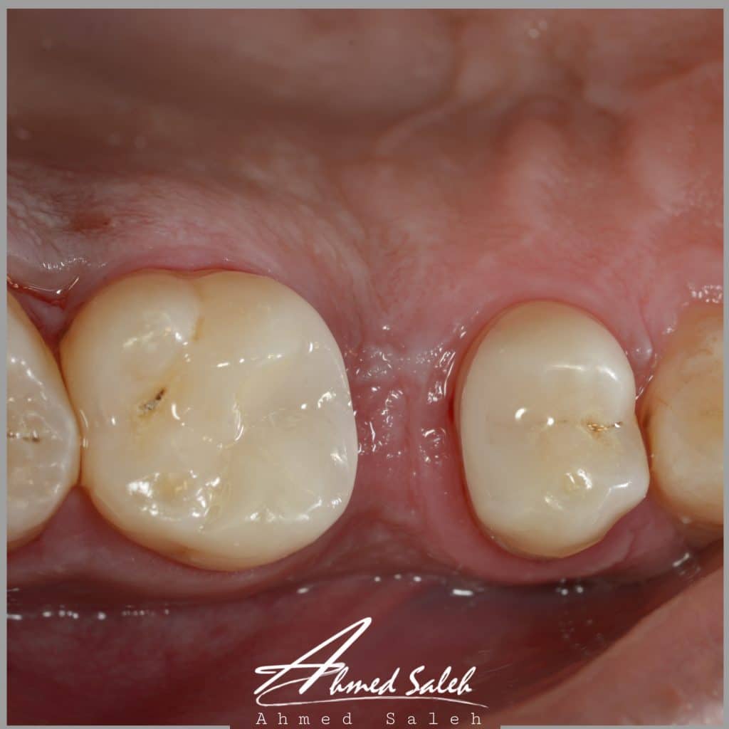 087AD9FC-FEE5-4618-BCFD-578803B828CB