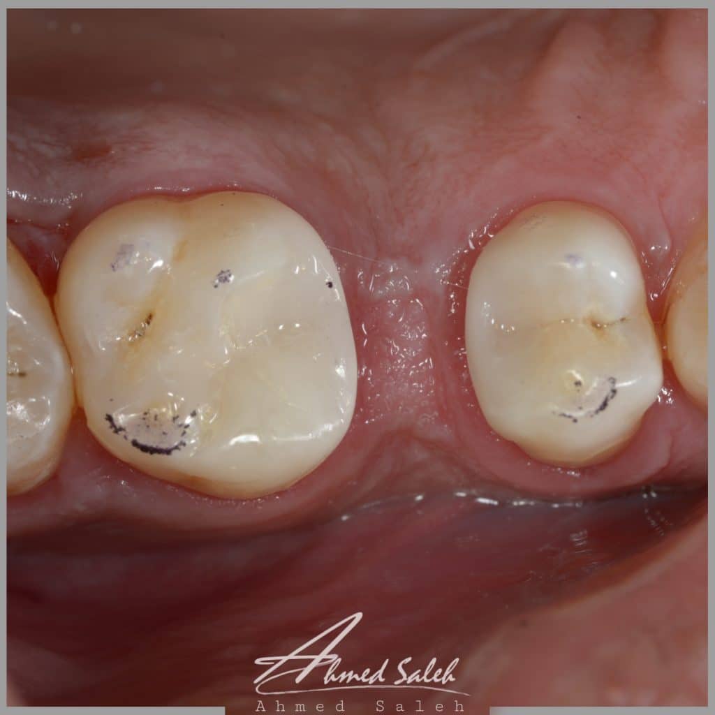 156E9C49-F7B3-4066-876F-40D4DD5166B1