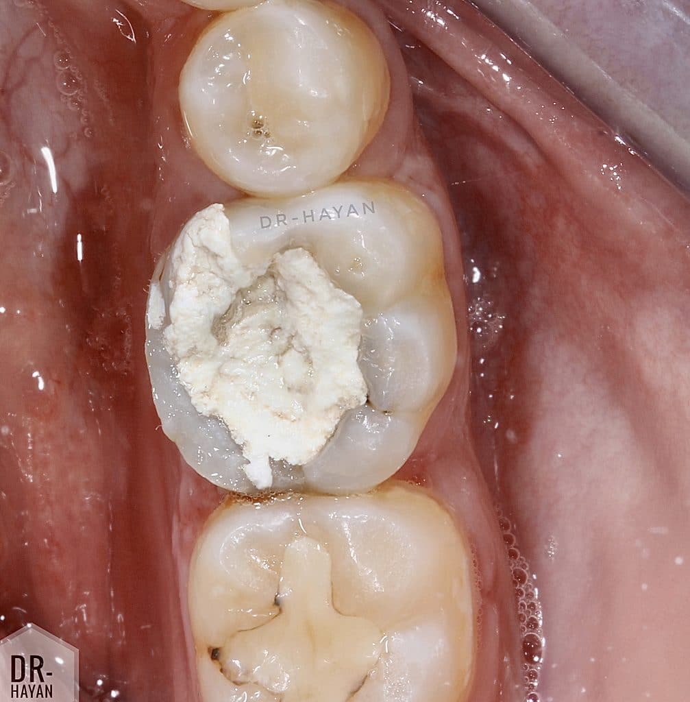 1735E904-9B50-4C80-9CAA-2DAA83F2F40F