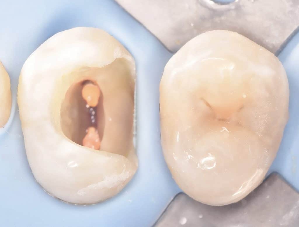 37D8B0C8-E406-4C64-BFE0-736720D88C8E