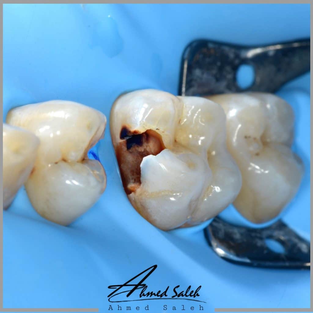 48CF8AA0-9BE8-461E-89A0-1BAAE763F6C4