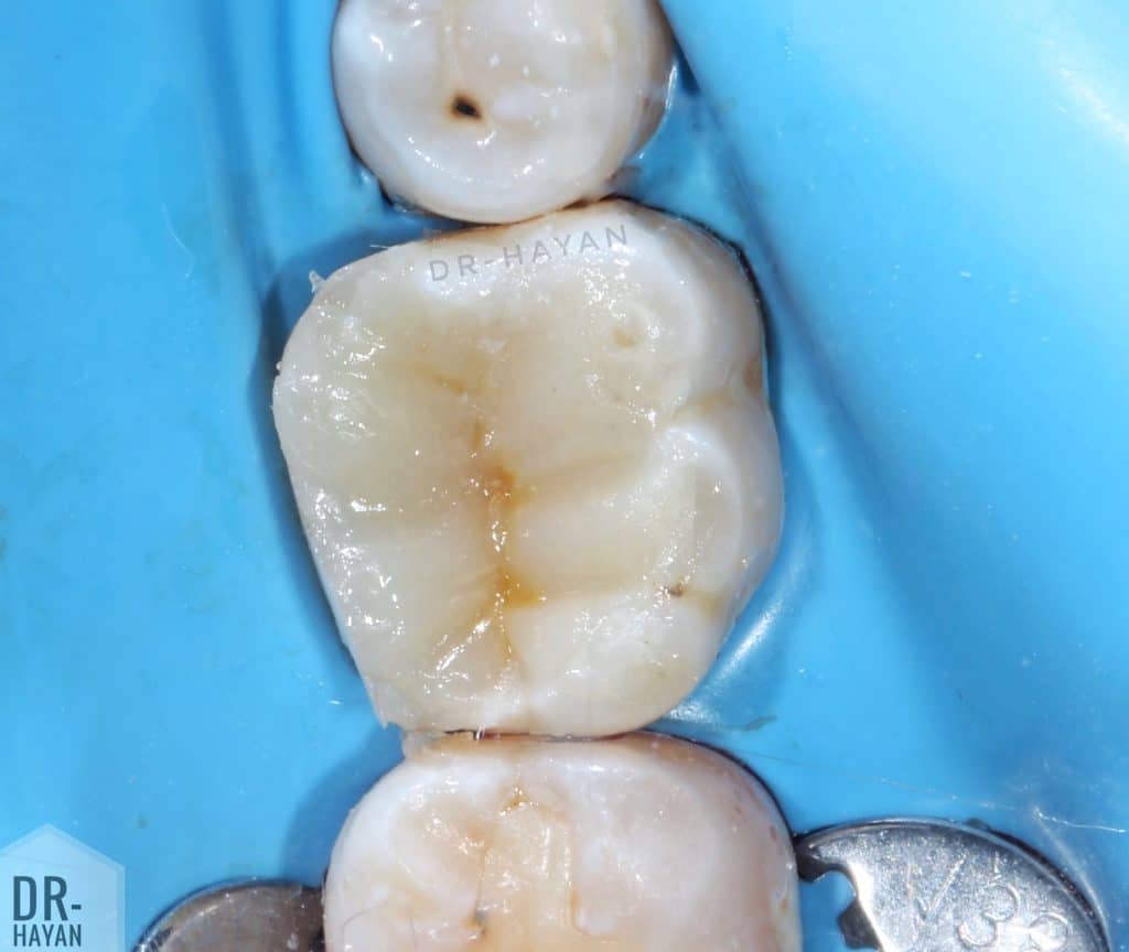 7D0BD95F-175C-4537-8E9A-0F0105473FE3