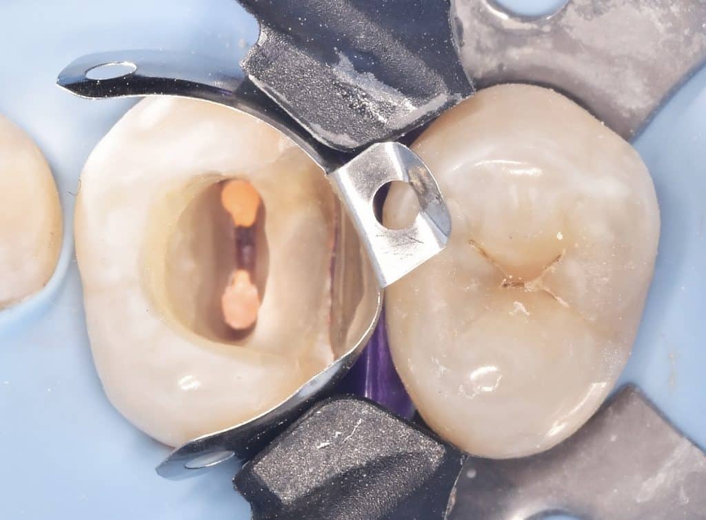 92D3CD59-4F8D-4E4F-9018-E7FE55753ED0