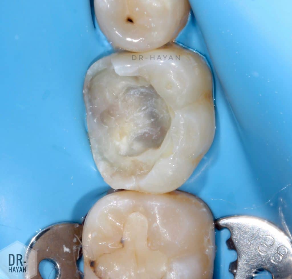 95A76B8F-8CEB-42FD-AF08-AA7DF6D50349