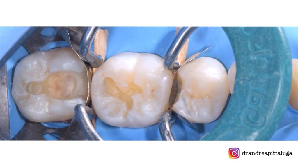 B9158361-1418-4EBB-A817-CA36D2255CAC