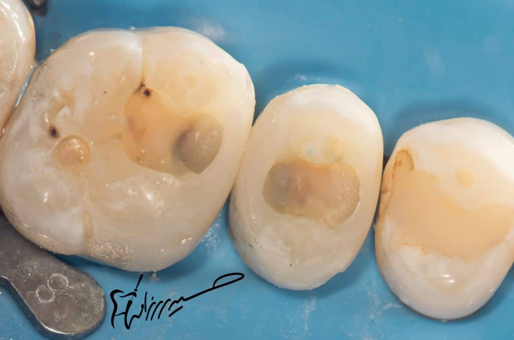 BFFF4550-865F-4DE4-A91C-2A8ADD786A5A