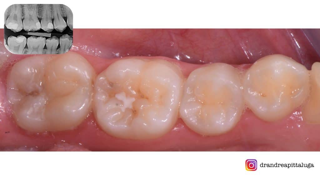 D099B06E-DAAC-4DCB-84B6-60D1826A0CE9