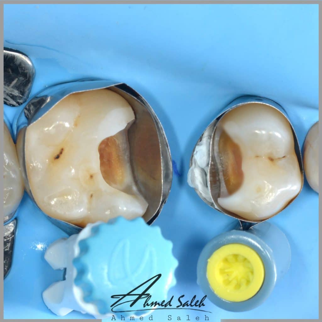 E0410C72-10A5-414A-B296-E14CF150EE71