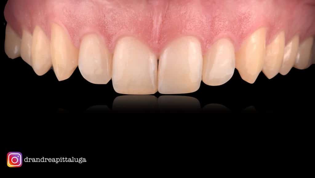 F1CEF1F7-9C8A-4D9B-9861-F4CB893D5EA6