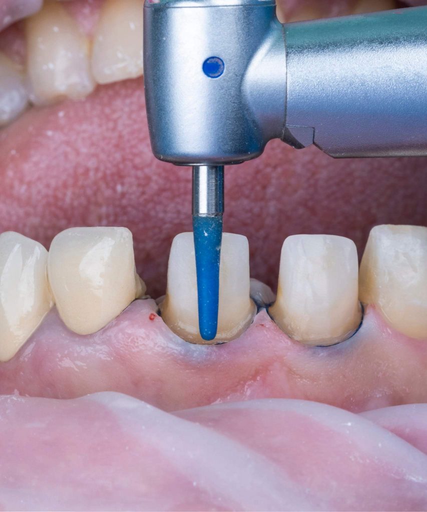 FB_IMG_1666426317077