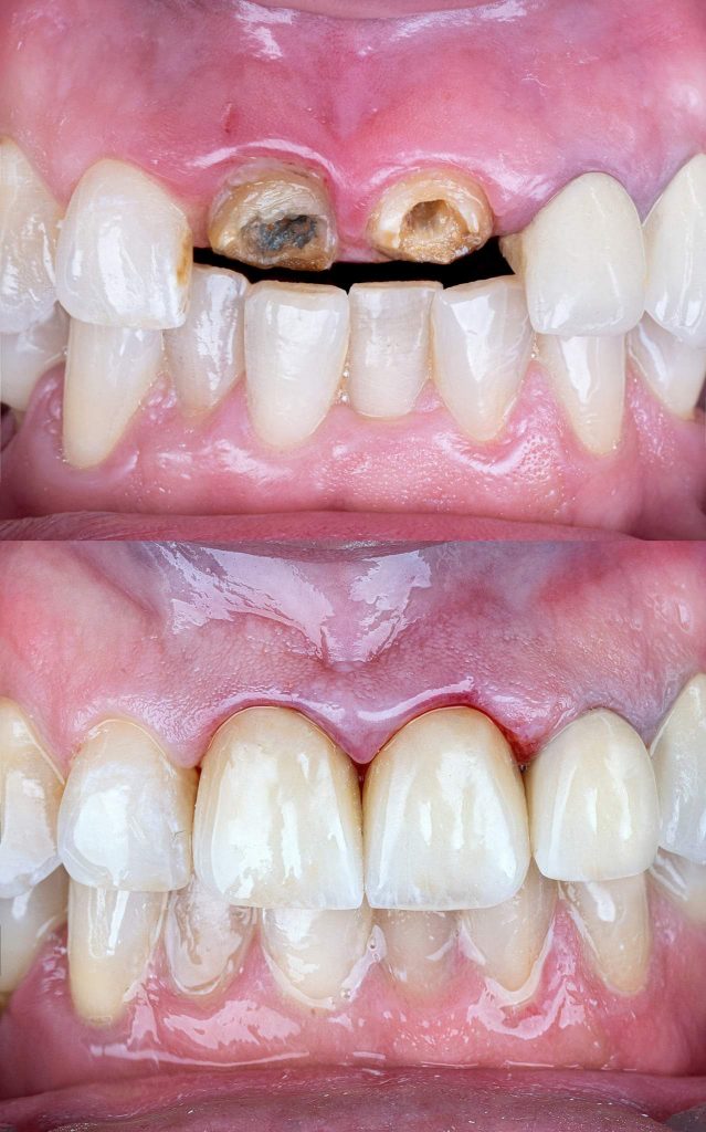 FB_IMG_1666426347044